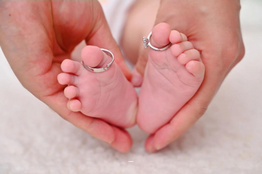 来宾孕妇肝内胆汁淤积症